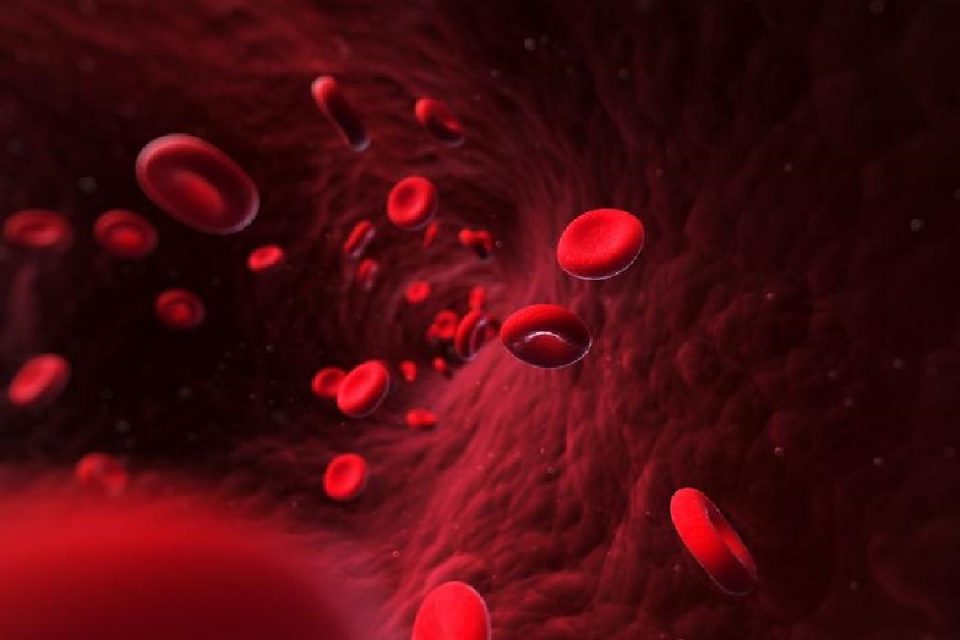 Blood Disorders That Lead to Stroke