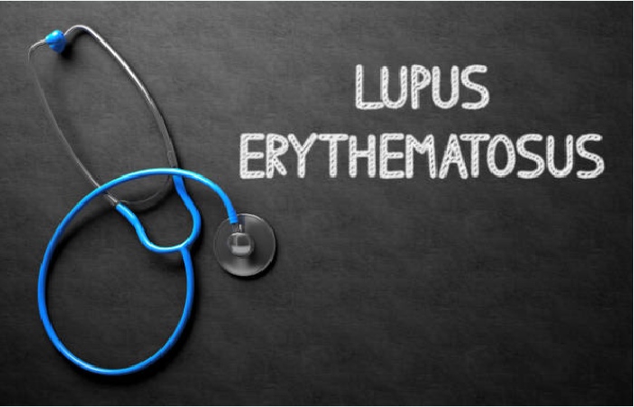 lupus erythematosus