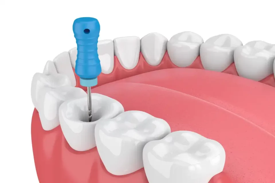 Endodontics