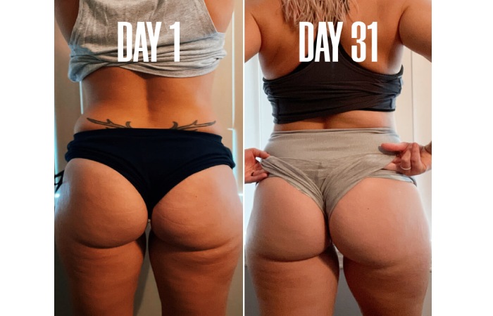 B Tight Before And After Pictures