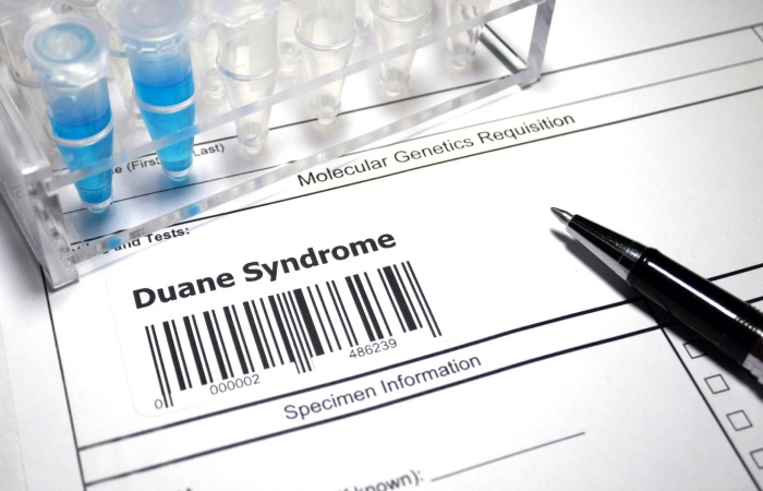 Duane Syndrome Write for Us