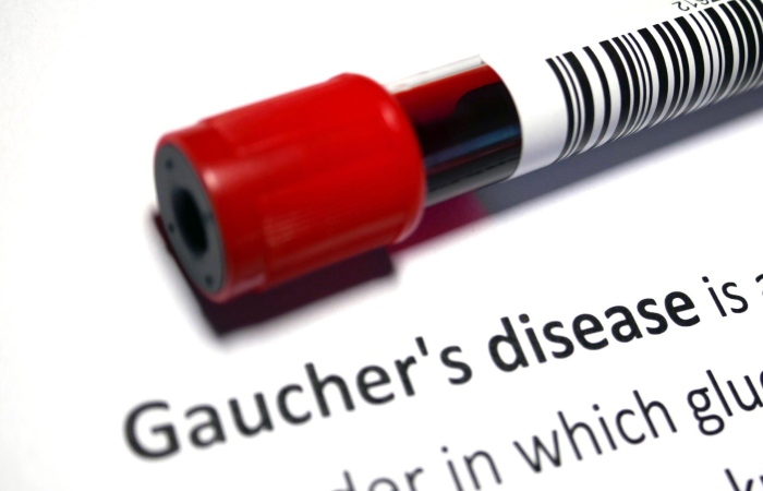 Gaucher Disease Write for Us