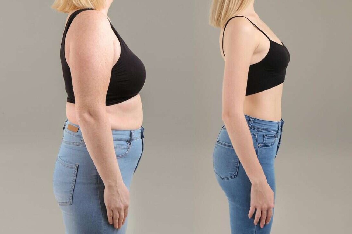 Image default