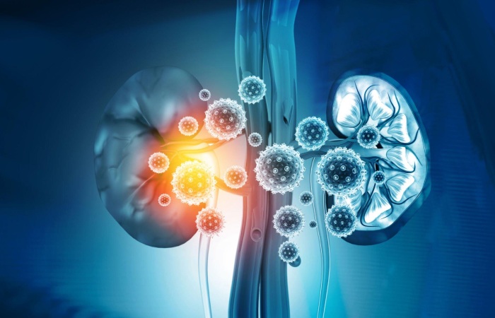 Comorbidity of Chronic Disease