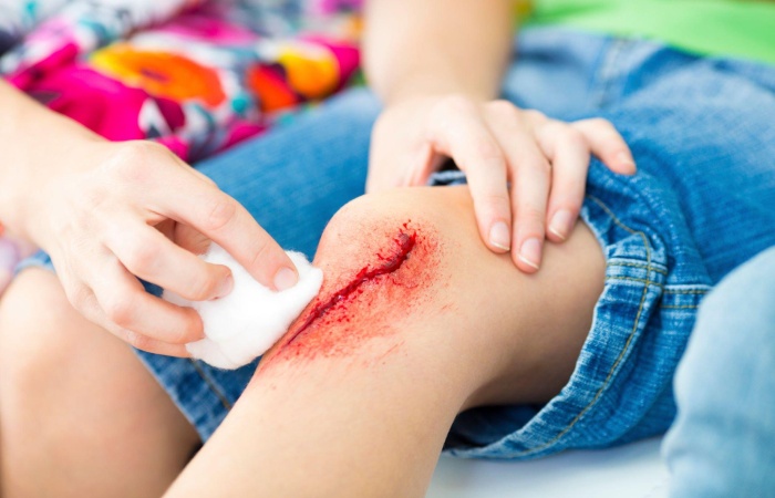 Injuries And Wounds Write For Us