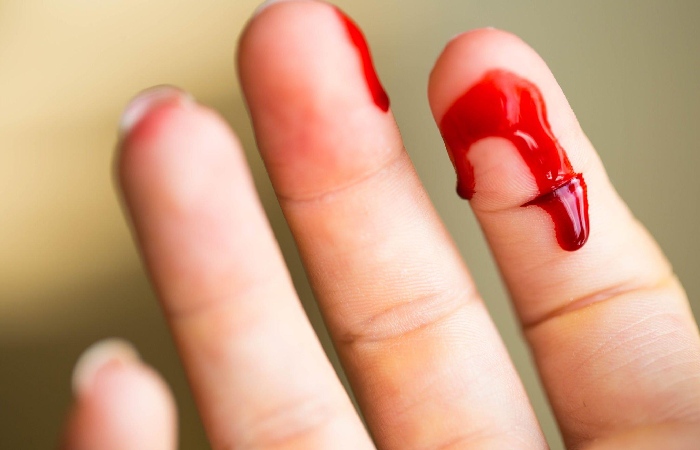 Burns from heat, chemicals, or electricity