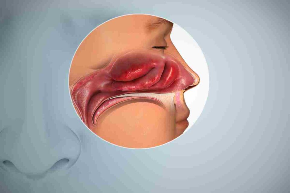 Anosmia