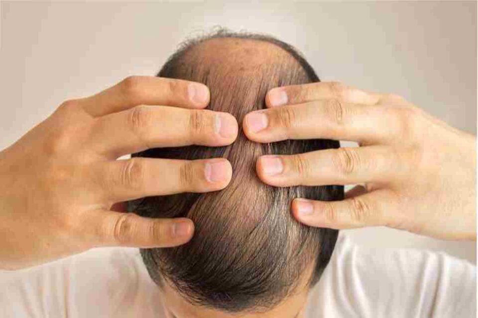 Nutrition Affects Hair Health