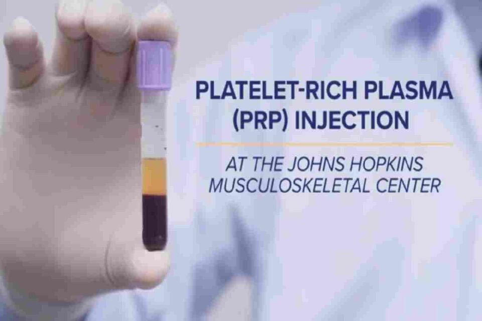 Platelet Rich Plasma